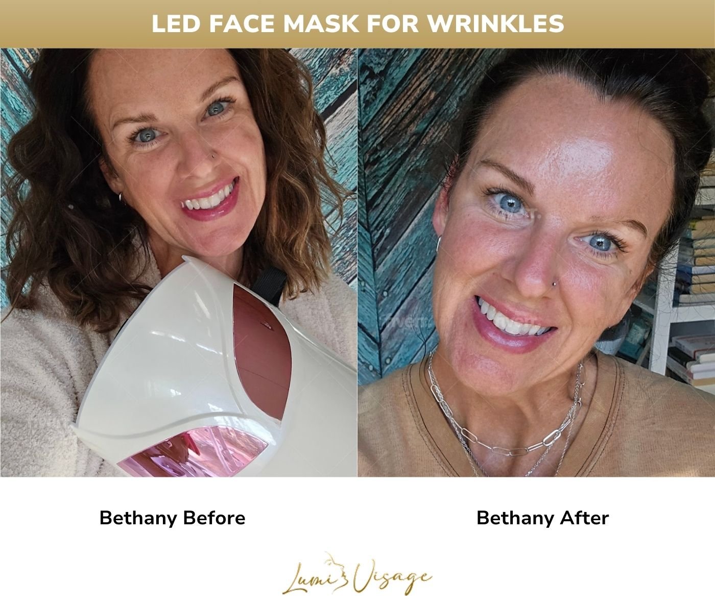 Bethany Before After